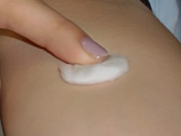 とめ~る君止血画像